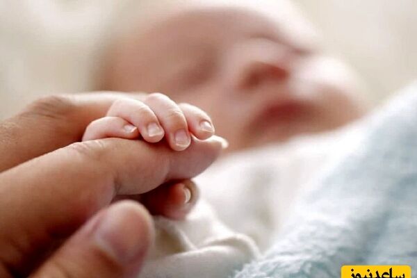 تولد نوزاد عجیب‌الخلقه با دو سر /پزشکان از دیدن نوزاد حیرت کردند + عکس