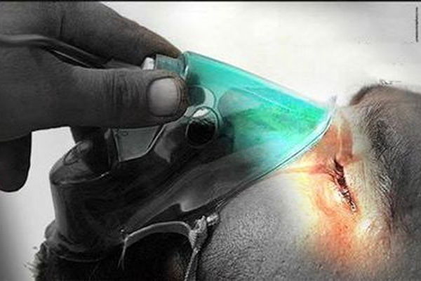 100 هزار جانباز شیمیایی در کشور داریم