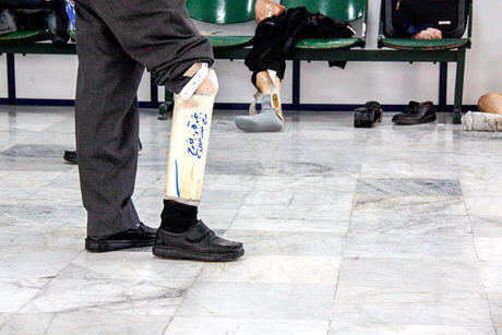 "بیمه توانبخشی" ضروری‌تر از "بیمه درمان"