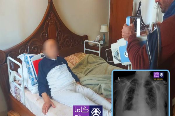 رادیولوژی در منزل مشهد گاما پرتو