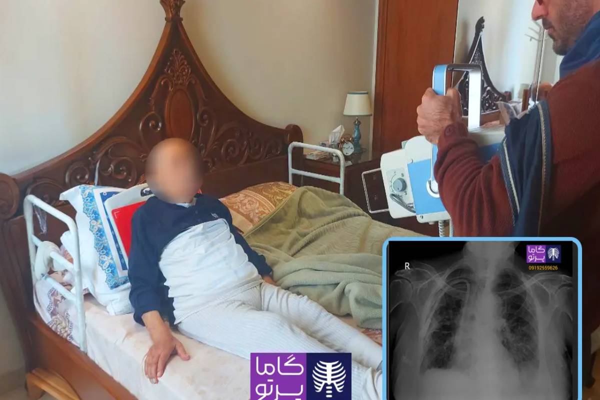 رادیولوژی در منزل مشهد گاما پرتو