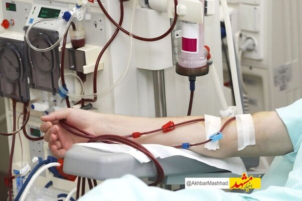 ۱۰۰۰ بیمار در بیمارستان منتصریه مشهد هر ماه دیالیز می‌شوند