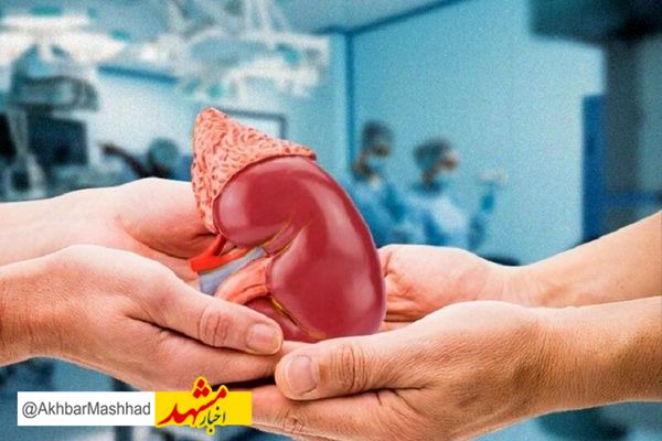 پیوند عضو از بیماران مرگ مغزی رایگان است
