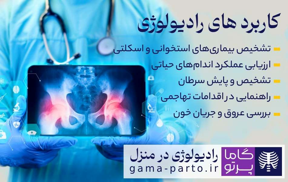 کاربردهای رادیولوژی چیست؟ - گاما پرتو