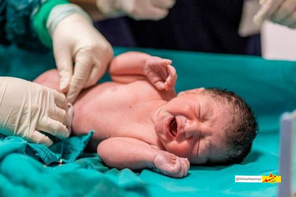 تولد نوزاد ۶ کیلویی در مشهد؛ هشداری درباره دیابت بارداری