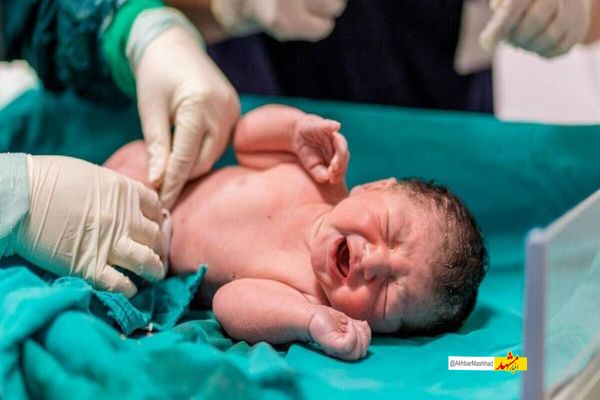 تولد نوزاد ۶ کیلویی در مشهد؛ هشداری درباره دیابت بارداری